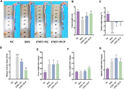 Polygonatum cyrtonema polysaccharides reshape the gut microbiota to ameliorate dextran sodium sulfate-induced ulcerative colitis in mice